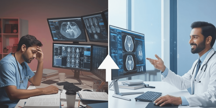 How Bionic AI Reduces Radiologist Burnout and Restores Job Satisfaction